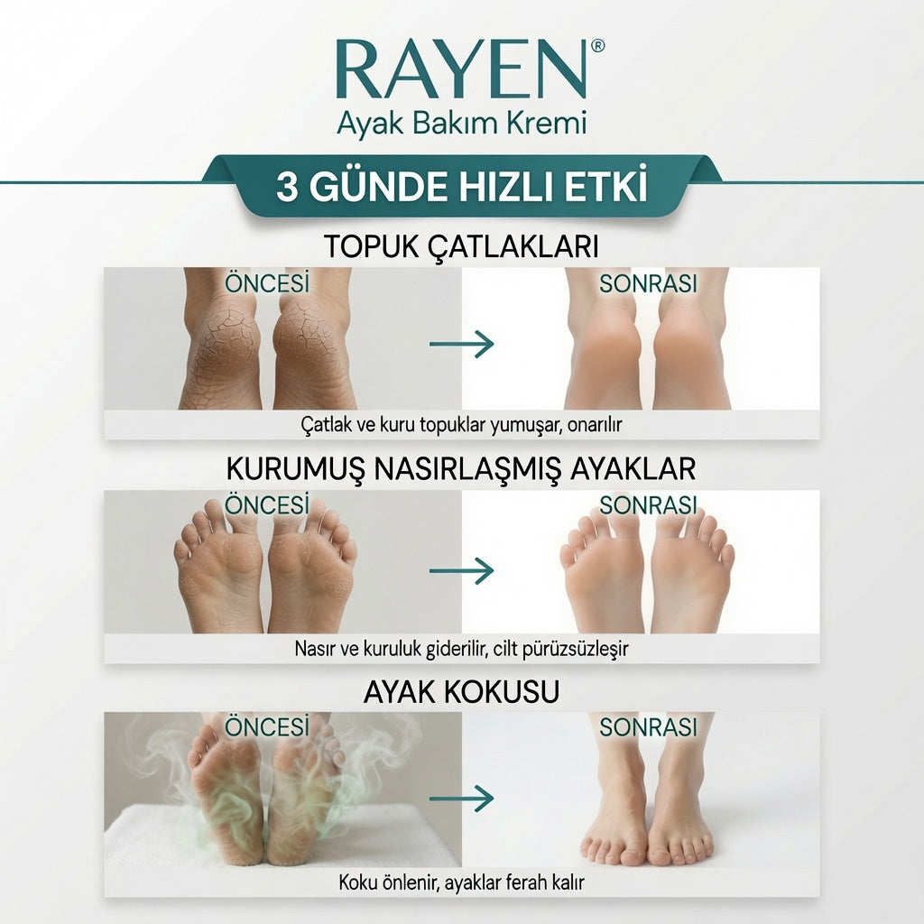 Rayen Komple Ayak Bakım Kremi 100 ml - Topuk Çatlaklarına, Sertleşmiş ve Nasırlaşmış Deriye, Ayak Kokusuna Karşı Yoğun Bakım ve Derinlemesine Nem Desteği