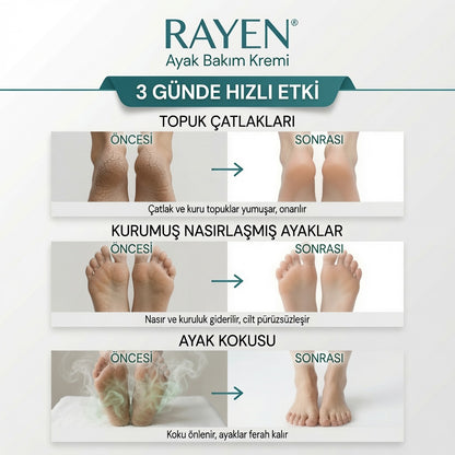 Rayen Komple Ayak Bakım Kremi 100 ml - Topuk Çatlaklarına, Sertleşmiş ve Nasırlaşmış Deriye, Ayak Kokusuna Karşı Yoğun Bakım ve Derinlemesine Nem Desteği